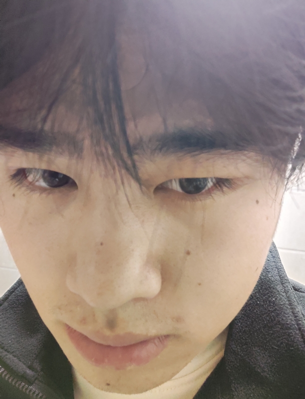 伤男的第一张照片--全国闪婚服务中心